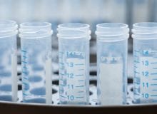 Een zeldzame oorzaak van HMSN