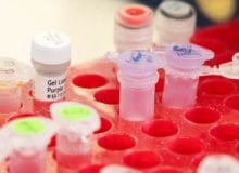 Verbetering van de behandeling van CIDP