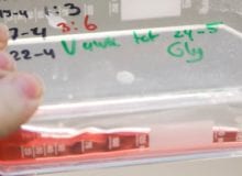 Nieuw onderzoek naar CIDP toegekend Nieuw onderzoek naar CIDP toegekend