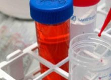 Onderzoek naar biomarkers voor CIDP afgerond Onderzoek naar biomarkers voor CIDP afgerond
