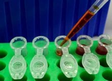 De rol van LRSAM1 bij het ontstaan van HMSN type 2