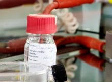 PGM1-deficiëntie: een metabole spierziekte met mogelijkheden voor therapie