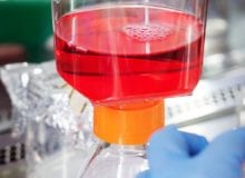 mRNA als sleutel tot verbeteren mogelijke Duchenne-therapieën