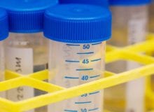 15 miljoen voor onderzoeken naar afweersysteem 15 miljoen voor onderzoeken naar afweersysteem