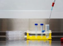 Spierstamceltherapie voor mitochondriële myopathie