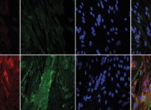 Op zoek naar een veiligere en nauwkeurigere gentherapie voor Duchenne