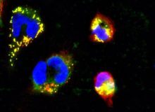 Mitochondriële defecten bij de oorzaak aanpakken