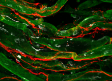 Op weg naar een klinische trial voor de ziekte van Pompe