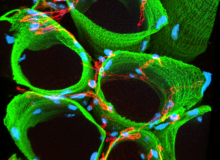 Met een speciaal schaartje de DNA-fout bij de ziekte van Duchenne herstellen