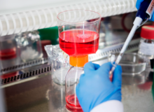 Onderzoek afgerond: antisense-therapie op maat voor myotone dystrofie