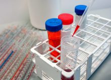 Meten van myotonie bij myotone dystrofie