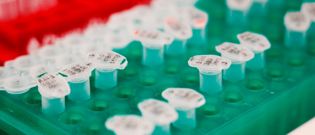 Nieuwe therapieën voorspellen voor kinderen met JDM