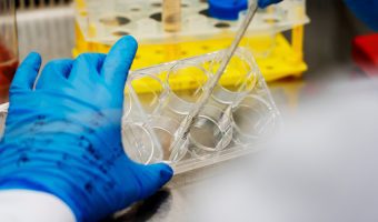 Veelbelovende ontdekking in FSHD-onderzoek