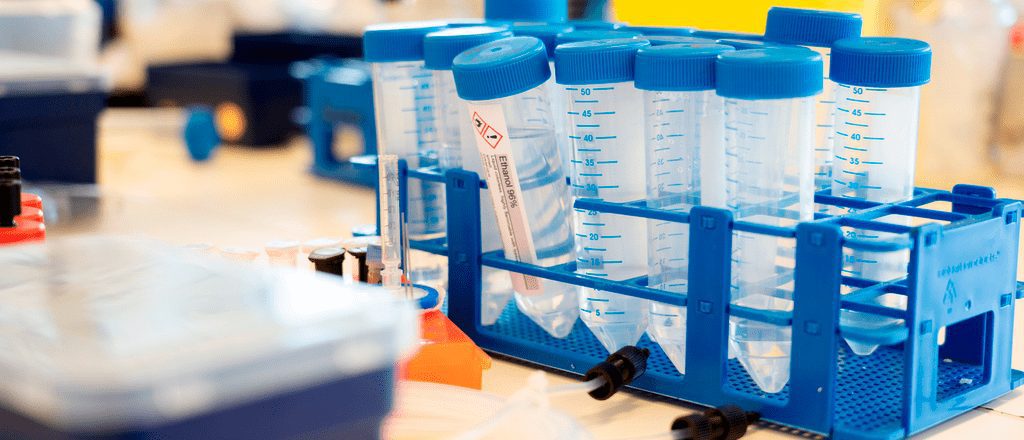 Op zoek naar genetische oorzaken voor ALS