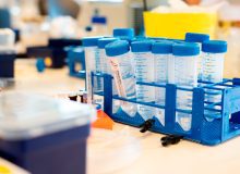 Op zoek naar genetische oorzaken voor ALS