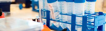 Op zoek naar genetische oorzaken voor ALS