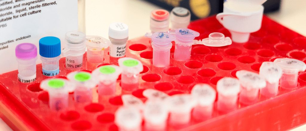 Magnetische hersenstimulatie als pijnbehandeling bij dunnevezelneuropathie