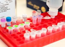 Magnetische hersenstimulatie als pijnbehandeling bij dunnevezelneuropathie