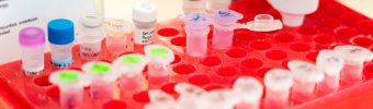 Magnetische hersenstimulatie als pijnbehandeling bij dunnevezelneuropathie