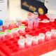 Magnetische hersenstimulatie als pijnbehandeling bij dunnevezelneuropathie