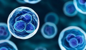 Eerste patiënt met zeldzame spierziekte behandeld met eigen stamcellen