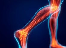 Leefstijlzorg op maat voor mensen met een spierziekte