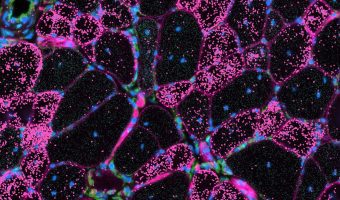 Hoeveel dystrofine is genoeg?